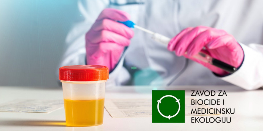 450 din za urinokulturu sa antibiogramom u Zavodu za biocide i medicinsku ekologiju na ...