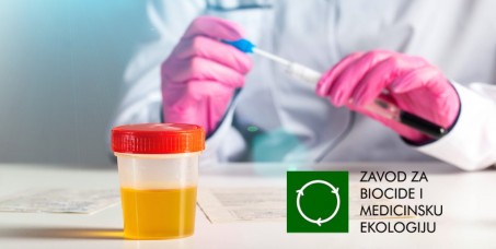 450 din za urinokulturu sa antibiogramom u Zavodu za biocide i medicinsku ekologiju na Banovom brdu!