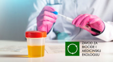 450 din za urinokulturu sa antibiogramom u Zavodu za biocide i medicinsku ekologiju na Banovom brdu!