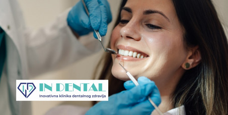 2700 din za uklanjanje kamenca u ordinaciji IN DENTAL u Novom Sadu!