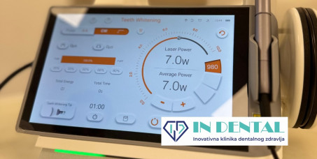 16200 din za lasersko beljenje zuba u ordinaciji IN DENTAL u Novom Sadu!