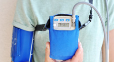 3000 din za Holter 24h krvnog pritiska, čitanje holtera, zaključak i terapija u ordinaciji Vračar Medical!