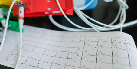 7000 din za ultrazvuk srca i holter EKG-a u HERZ MEDIKA na Vračaru!
