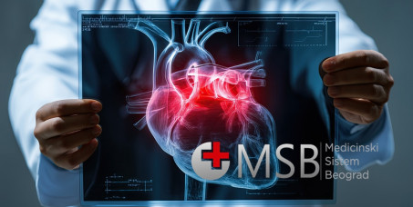 4500 din za mini sistematski internistički : pregled interniste + ekg + UZ srca i gratis UZ abdomena u Zavodu MSB na Novom Beogradu (kod Crowne Plaze)!