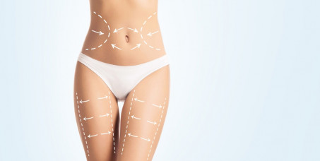 1900 din za ️2 vakum fit tretmana za oblikovanje tela u studiju LADY 9 u Zemunu!