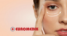 15900 din za tretman područja oko očiju (Botox+ Biorevitalizacija kože)u Euromediku na Slaviji!