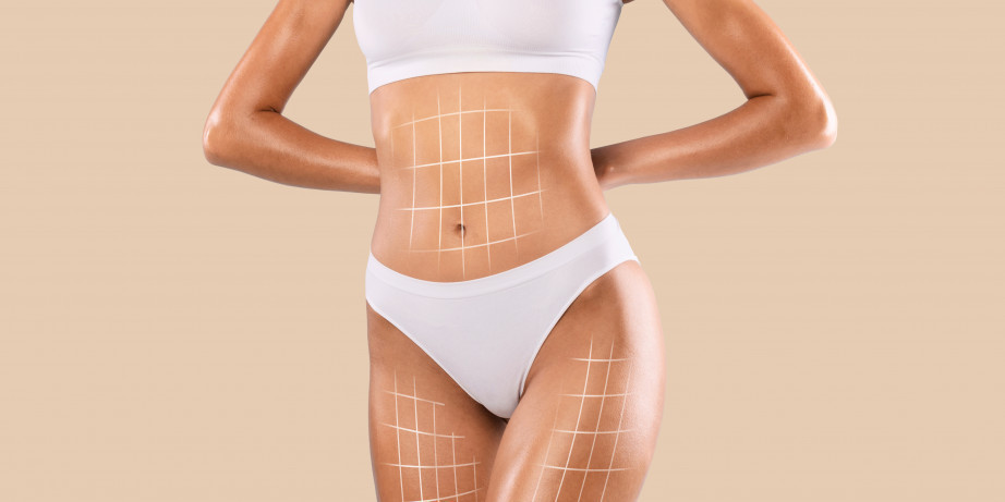 4000 din za lipolizu jedne regije (podbradak, unutra&scaron;njost butine, nadlaktice ili pola  ...