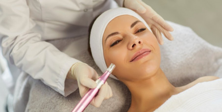 3900 din za dermapen tretman lica (60 min) u salonu Professional beauty and spa u Žarkovu!