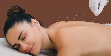 6000 din za akupunkturu, &scaron;iacu i laseroterapiju (60-75min) u ProHealth klinici u centru Vračara!