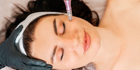4000 din za mezoterapiju lica 90 minuta (či&scaron;ćenje,enzimski piling,masaža,mezoterapija,led maska) u ABRAKADABRA SPA centru!