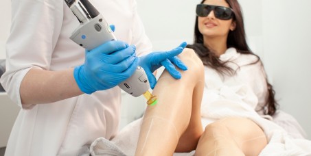 5500 din za lasersku epilaciju nogu i intime u salonu Professional beauty and spa u Žarkovu!