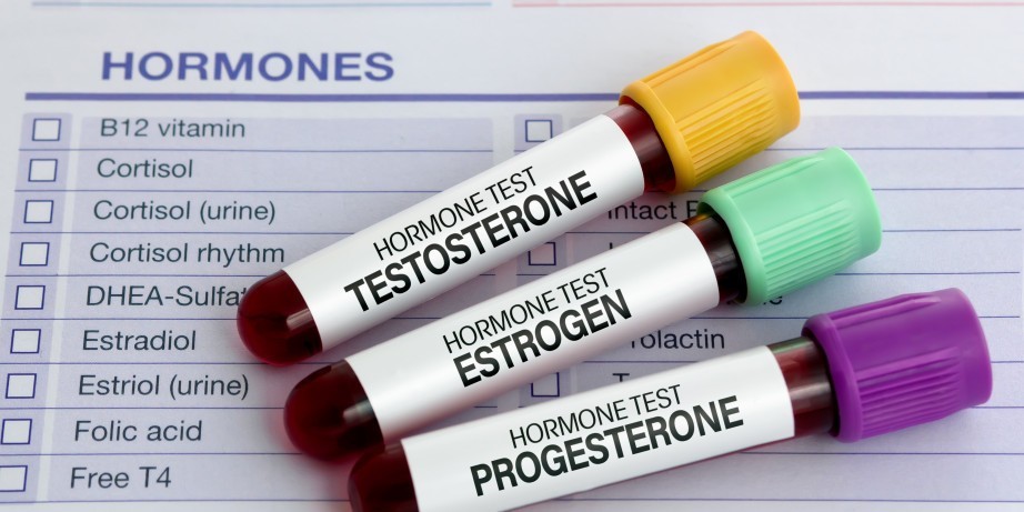 1800 din za STANDARD analizu polnih hormona (Fsh LH estradiol) - Millenium Medic!