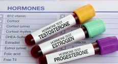 1800 din za STANDARD analizu polnih hormona (Fsh LH estradiol) - Millenium Medic!