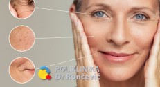 8000 din za tretman CO2 frakcionisanim laserom za uklanjanje bora u poliklinici Dr Rončević!