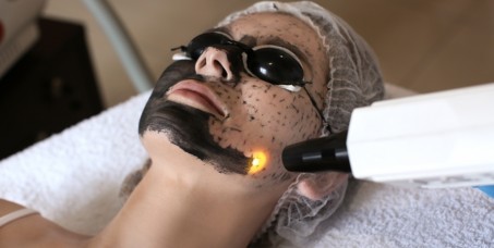 7000 din za carbon piling tretman u SOLAR MEDICAL CENTRU!
