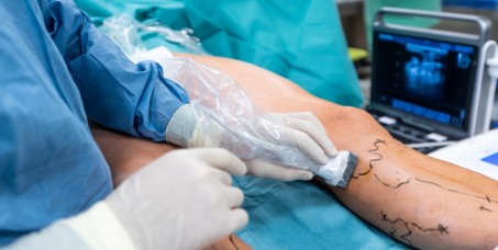 10000 din za pregled vaskularnog hirurga + ultrazvuk (krvnih sudova nogu, krvnih sudova vrata ili abdominalne aorte) u ProHealth klinici u centru grada!