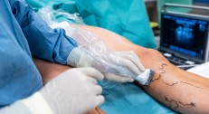 10000 din za pregled vaskularnog hirurga + ultrazvuk (krvnih sudova nogu, krvnih sudova vrata ili abdominalne aorte) u ProHealth klinici u centru grada!